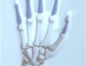 doctores especialistas en mano y hombro cirujanos especialistas en mano